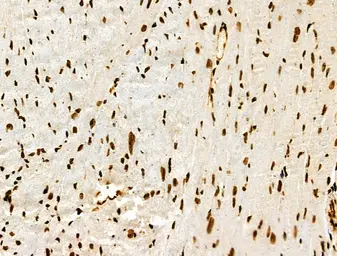 Anti-Histone H3K9K14K23K27ac (Acetyl Lys9/Lys14/Lys23/Lys27) antibody used in IHC (Paraffin sections) (IHC-P). GTX02535