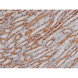 Anti-alpha Synuclein (phospho Ser129) antibody used in IHC (Paraffin sections) (IHC-P). GTX02537