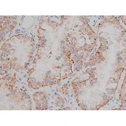 Anti-alpha Synuclein (phospho Ser129) antibody used in IHC (Paraffin sections) (IHC-P). GTX02537