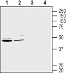 Anti-GLUT2 antibody used in Western Blot (WB). GTX02542