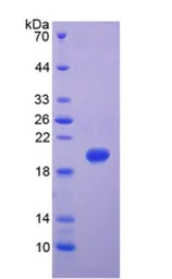 Human MMP9 protein, His tag (Active). GTX02551-pro