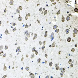Anti-FGF1 antibody used in IHC (Paraffin sections) (IHC-P). GTX02555