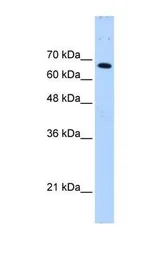 Anti-CDC4 antibody used in Western Blot (WB). GTX02557