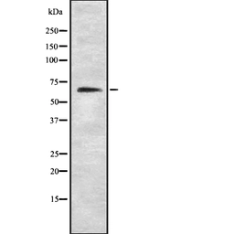 Anti-NOX1 antibody used in Western Blot (WB). GTX02577