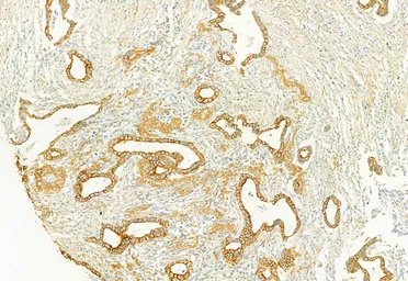 Anti-PLCE1 antibody used in IHC (Paraffin sections) (IHC-P). GTX02580
