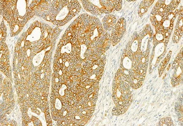 Anti-PLCE1 antibody used in IHC (Paraffin sections) (IHC-P). GTX02580