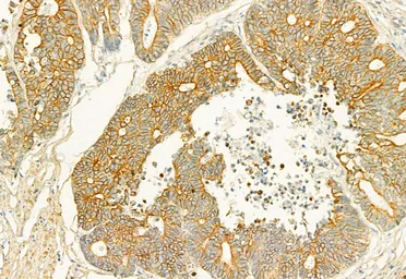 Anti-PLCE1 antibody used in IHC (Paraffin sections) (IHC-P). GTX02580