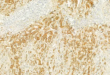 Anti-PLCE1 antibody used in IHC (Paraffin sections) (IHC-P). GTX02580