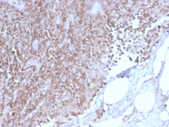 Anti-CD3 epsilon antibody [C3e/2858R] used in IHC (Paraffin sections) (IHC-P). GTX02604