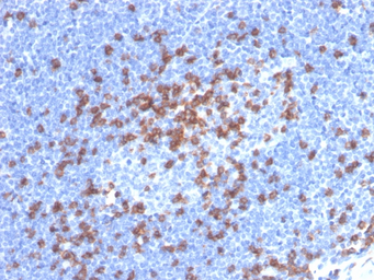 Anti-CD8 alpha antibody [CD8/4391R] used in IHC (Paraffin sections) (IHC-P). GTX02616