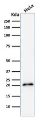 Anti-p21 Cip1 antibody [CIP1/2275R] used in Western Blot (WB). GTX02619
