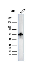 Anti-FOXA1 antibody [FOXA1/2230R] used in Western Blot (WB). GTX02640