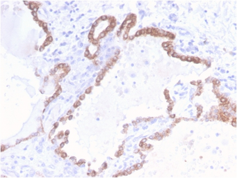 Anti-Cytokeratin 18 antibody [KRT18/2808R] used in IHC (Paraffin sections) (IHC-P). GTX02657