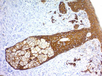 Anti-Cytokeratin 2 antibody [KRTH/1576R] used in IHC (Paraffin sections) (IHC-P). GTX02663