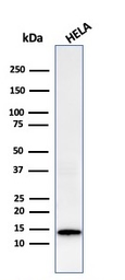 Anti-Galectin 1 antibody [GAL1/2499R] used in Western Blot (WB). GTX02670