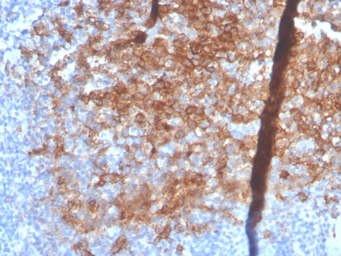 Anti-Syndecan-1 / CD138 antibody [SDC1/4378R] used in IHC (Paraffin sections) (IHC-P). GTX02707