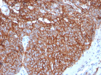 Anti-GluT1 antibody [GLUT1/3132R] used in IHC (Paraffin sections) (IHC-P). GTX02708