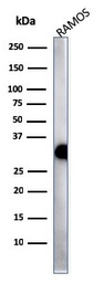 Anti-MHC Class II antibody [HLA-Pan/2967R] used in Western Blot (WB). GTX02758