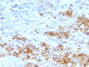 Anti-CA19-9 antibody [CA19.9/1390R] used in IHC (Paraffin sections) (IHC-P). GTX02763