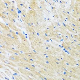 Anti-BAG3 antibody used in IHC (Paraffin sections) (IHC-P). GTX02777