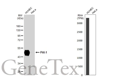 Anti-PAI-1 antibody [GT1223] used in Western Blot (WB). GTX02817