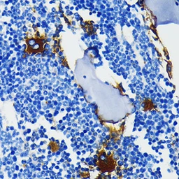 Anti-Integrin beta 3 antibody [GT1226] used in IHC (Paraffin sections) (IHC-P). GTX02823