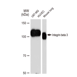 Anti-Integrin beta 3 antibody [GT1226] used in Western Blot (WB). GTX02823