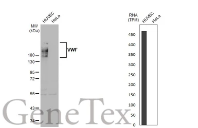 Anti-VWF antibody [GT1230] used in Western Blot (WB). GTX02827