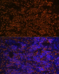 Anti-Hemoglobin alpha antibody [GT1234] used in IHC (Paraffin sections) (IHC-P). GTX02831