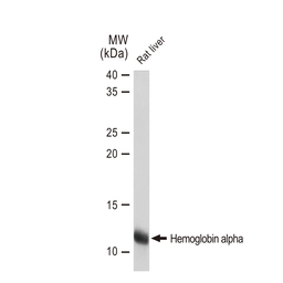 Anti-Hemoglobin alpha antibody [GT1234] used in Western Blot (WB). GTX02831