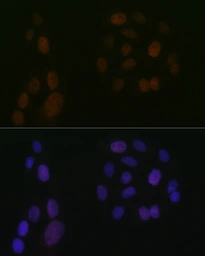 Anti-5-Lipoxygenase antibody [GT1241] used in Immunocytochemistry/ Immunofluorescence (ICC/IF). GTX02838