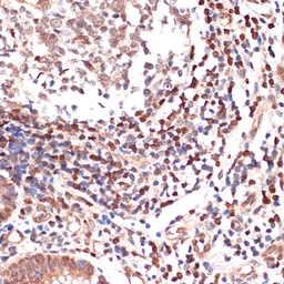 Anti-5-Lipoxygenase antibody [GT1241] used in IHC (Paraffin sections) (IHC-P). GTX02838