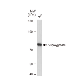 Anti-5-Lipoxygenase antibody [GT1241] used in Western Blot (WB). GTX02838