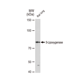 Anti-5-Lipoxygenase antibody [GT1241] used in Western Blot (WB). GTX02838