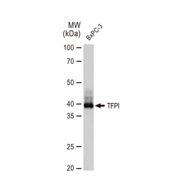 Anti-TFPI antibody [GT1246] used in Western Blot (WB). GTX02843