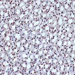 Anti-ILF3 antibody [GT1247] used in IHC (Paraffin sections) (IHC-P). GTX02844