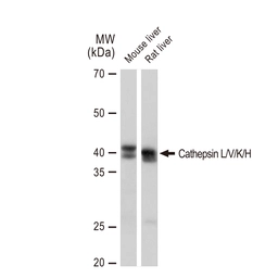 Anti-Cathepsin L/V/K/H antibody [GT1252] used in Western Blot (WB). GTX02849