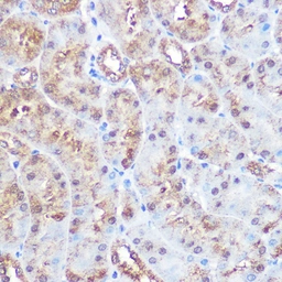 Anti-ERK5 antibody [GT1258] used in IHC (Paraffin sections) (IHC-P). GTX02855