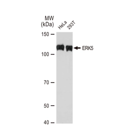 Anti-ERK5 antibody [GT1258] used in Western Blot (WB). GTX02855