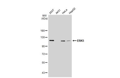 Anti-ERK5 antibody [GT1258] used in Western Blot (WB). GTX02855