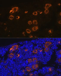 Anti-PF4 antibody [GT1260] used in IHC (Paraffin sections) (IHC-P). GTX02857