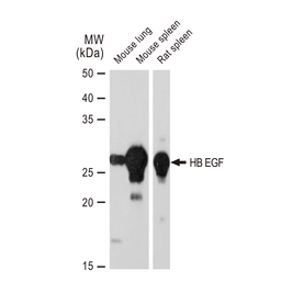 Anti-HB EGF antibody [GT1263] used in Western Blot (WB). GTX02860
