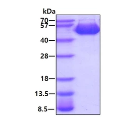 Mouse ENTPD6 protein, His tag (active). GTX02863-pro