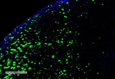 Anti-Hexanoyl-Lysine adduct antibody [5D9] used in IHC (Paraffin sections) (IHC-P). GTX02872