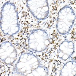 Anti-C6ORF150 antibody used in IHC (Paraffin sections) (IHC-P). GTX02874