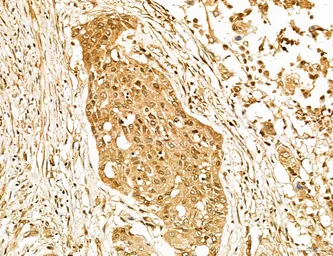 Anti-LASS2 antibody used in IHC (Paraffin sections) (IHC-P). GTX02887