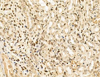 Anti-LASS2 antibody used in IHC (Paraffin sections) (IHC-P). GTX02887
