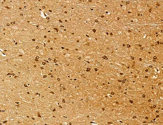 Anti-LASS2 antibody used in IHC (Paraffin sections) (IHC-P). GTX02887