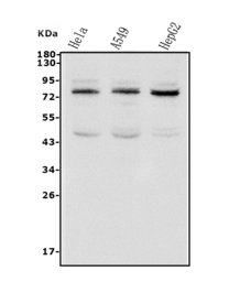Anti-TAB2 antibody used in Western Blot (WB). GTX02891