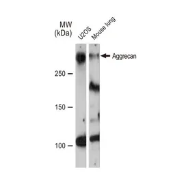 Anti-Aggrecan antibody [GT1267] used in Western Blot (WB). GTX03179